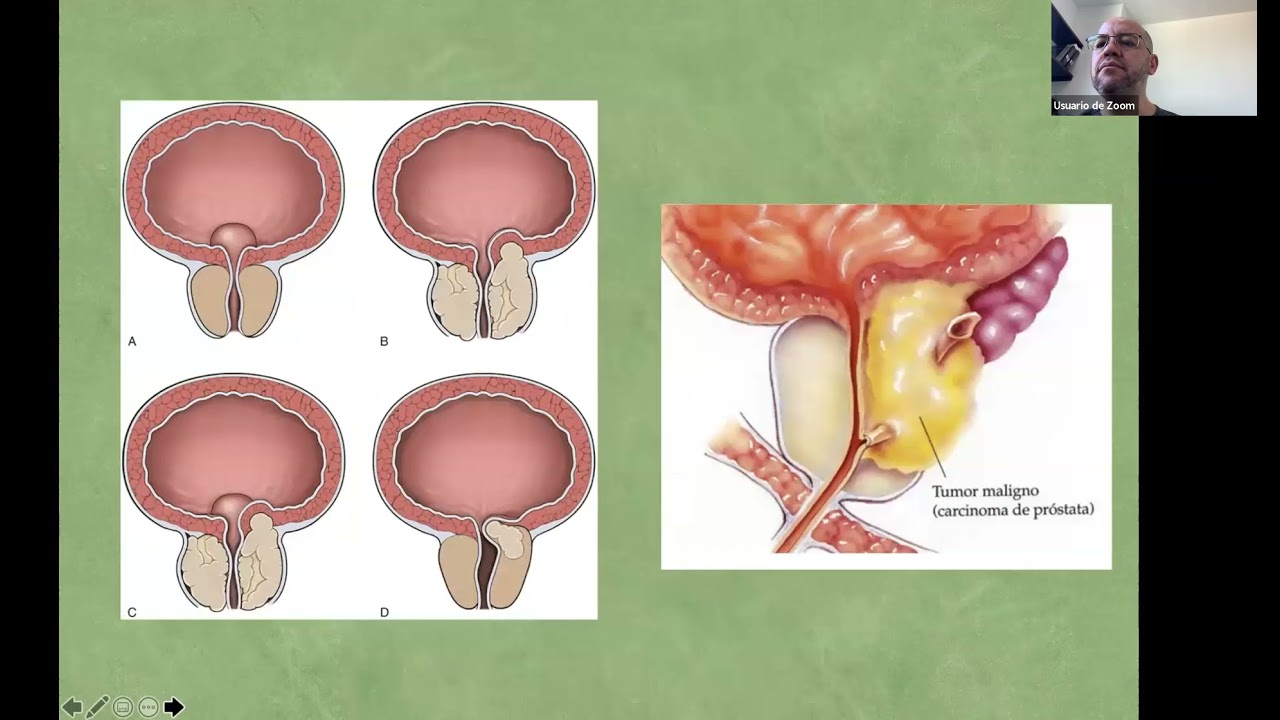 Gilberto Romo Sánchez-4