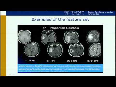 Neuroimaging Predictors of Survival, Pathology, and Molecular Profiles... - David Gutman