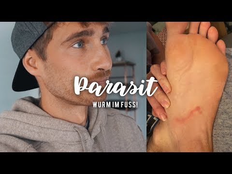 PARASIT IM Fuß - Mitbringsel aus Brasilien #vlog Nr. 493 | MANDA