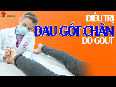 Đau gót chân do GOUT - Điều trị thế nào?