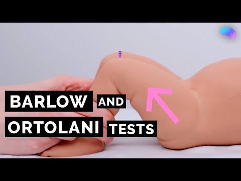 Barlow, Ortolani and Galeazzi tests | NIPE | OSCE | CPSA | PLAB 2