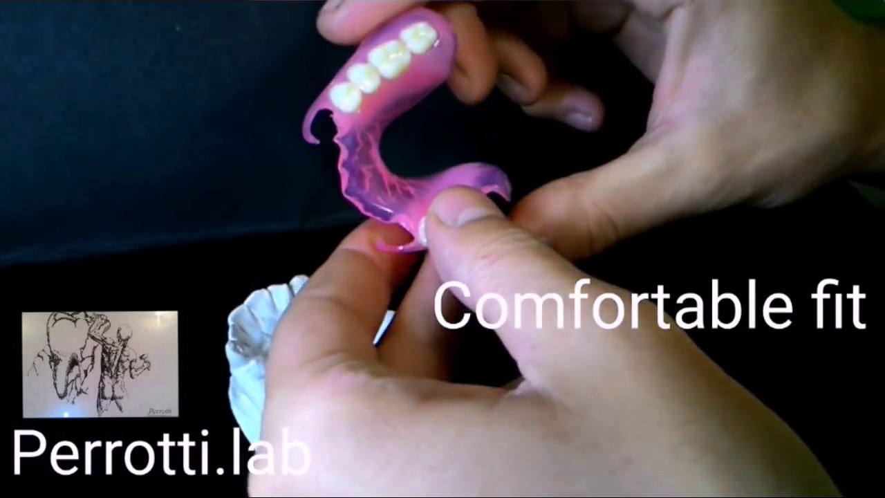 Nuova protesi flessibile. New prosthesis flexible. No Valplast, no Deflex, no Flexite, no Tcs.