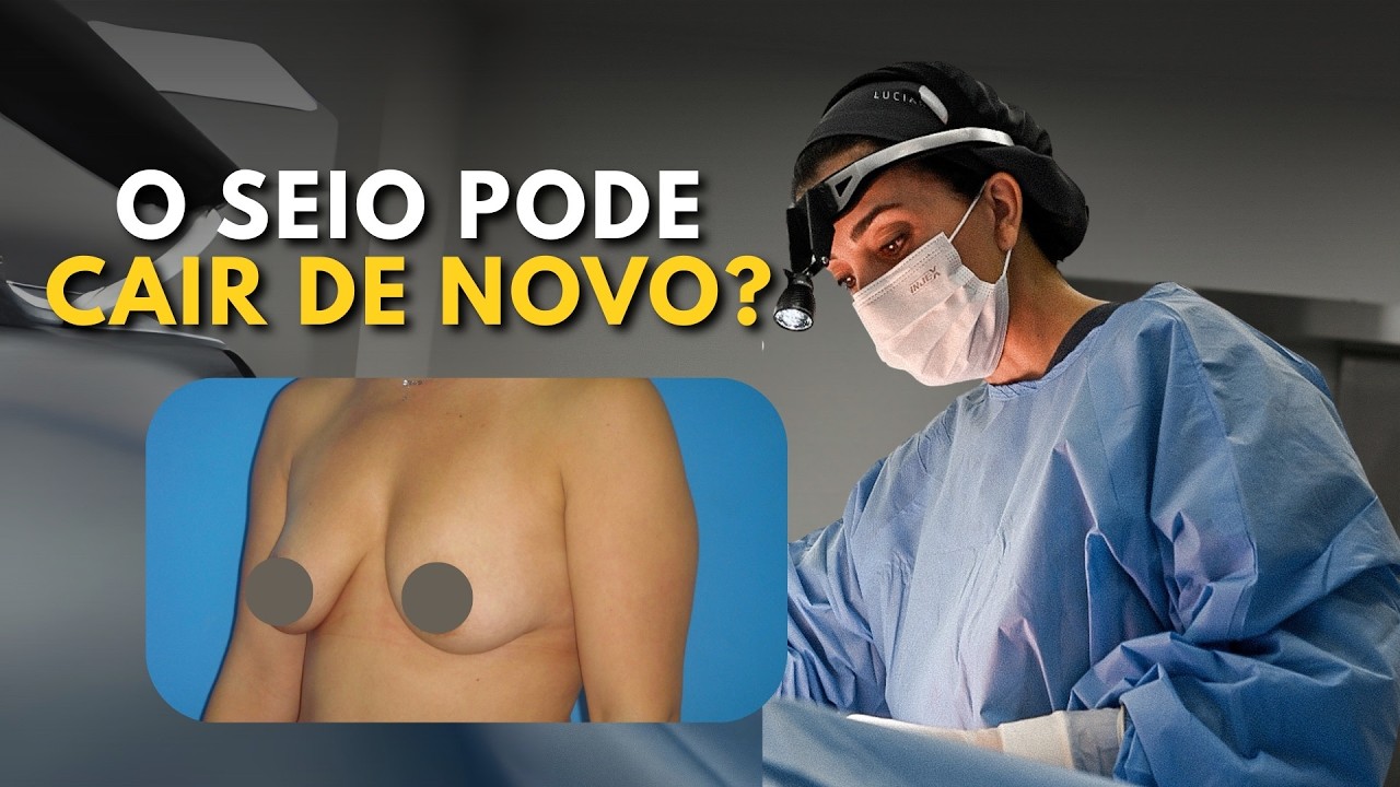 Mastopexia com ou sem prótese: o que faz o seio cair de novo?