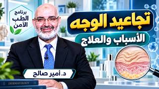 تجاعيد الوجه الأسباب والعلاج برنامج الطب الأمن مع دكتور أمير صالح