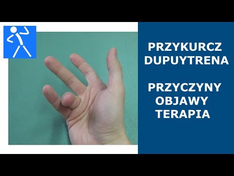Operacja deformacji stóp Kości na palucha u mężczyzn leczonych w domu