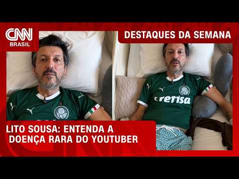 Creutzfeldt-Jakob: Médico explica doença rara diagnosticada em Lito Sousa | DESTAQUES DA SEMANA