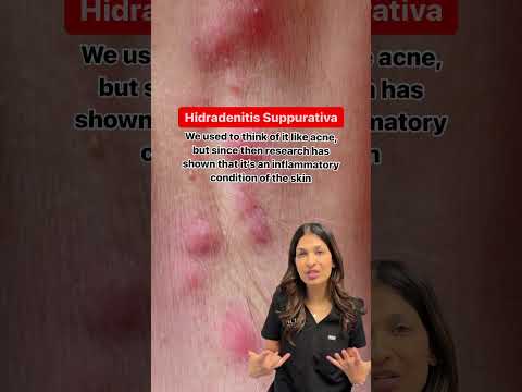 Hidradenitis Suppurativa (HS)