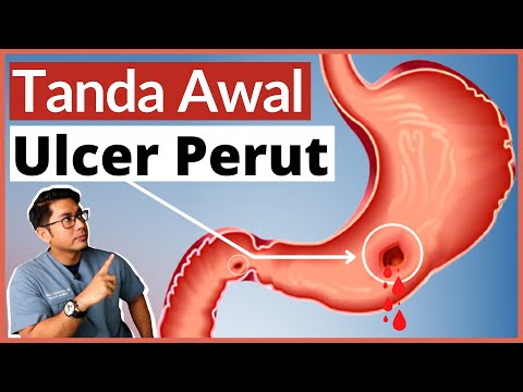 , title : 'Ulcer Perut | Gastrik & Angin | 5 Tanda Awal Wajib Tahu | Doctor Sani |'