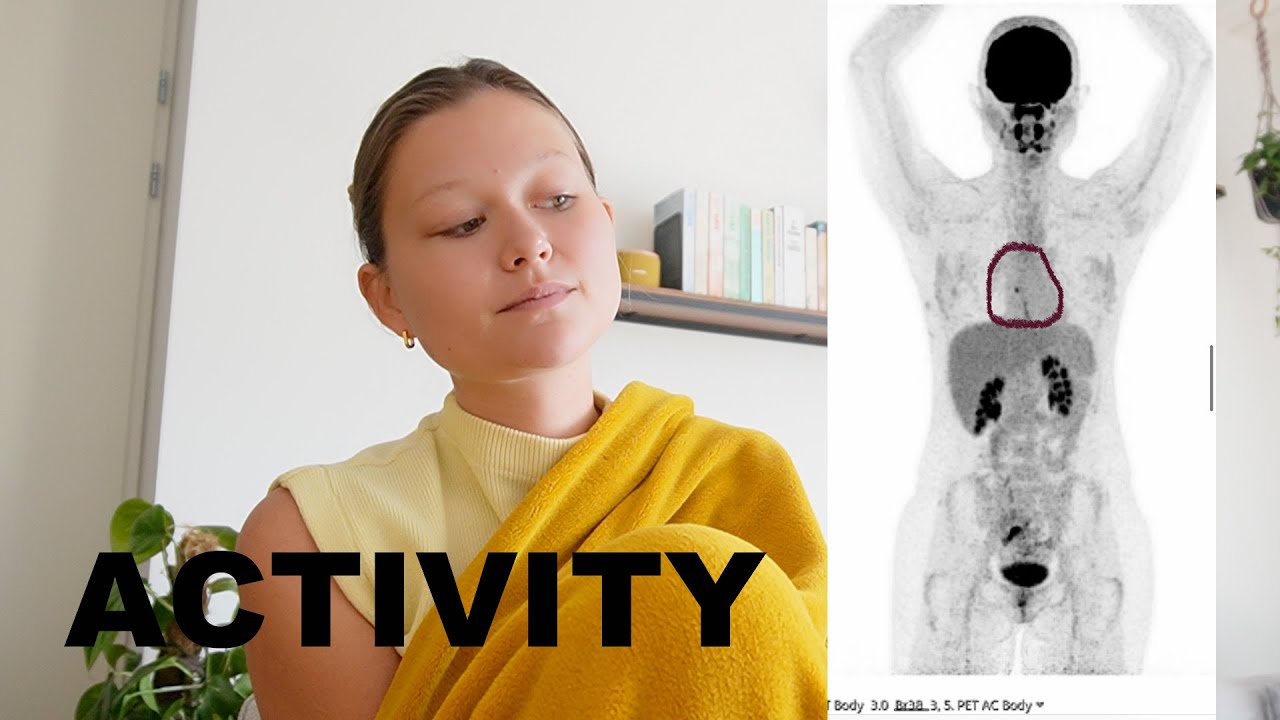 Why I've Been MIA || New Pet Scan Results