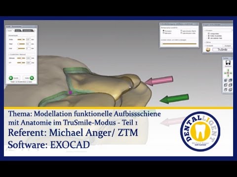 EXOCAD TUTORIAL - CAD/CAM - Model. funkt. Aufbißschiene mit Anatomie im TruSmile-Modus - Teil 1
