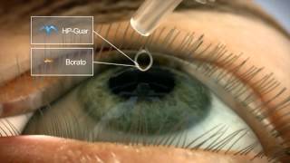 oftalmologo Tenerife Sindrome Ojo Seco Systane con acido hialuronico