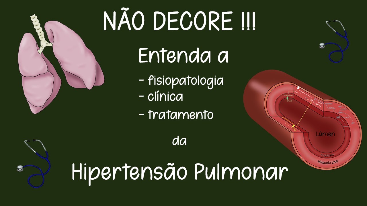 Pneumologia - Hipertensão Pulmonar (definição, causas, clínica, imagem, tratamento)
