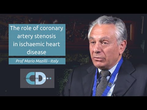 The role of coronary artery stenosis in ischaemic heart disease - Prof Mario Mazilli