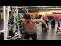 Surgery to Stage || Hip Surgery Transformation Video