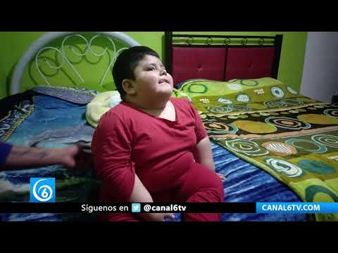 Video: Kenahan un pequeño guerrero que lucha contra el síndrome de Prader Wili