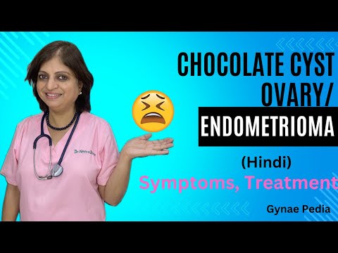 Endometrioma / Chocolate Cyst of Ovary: Symptoms, Medical Surgical treatment | Hindi | Dr NeeraBhan