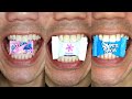 Best ASMR Videos In August DoctorTristanPeh ASMR