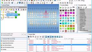 Dentrix Chairside Planner