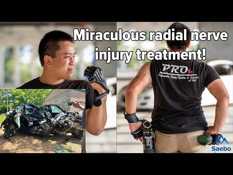 Lifechanging Radial Nerve Injury Treatment!  (Testimonial & Demonstration)