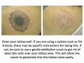 How to Remove a Tattoo With Home Remedies ...