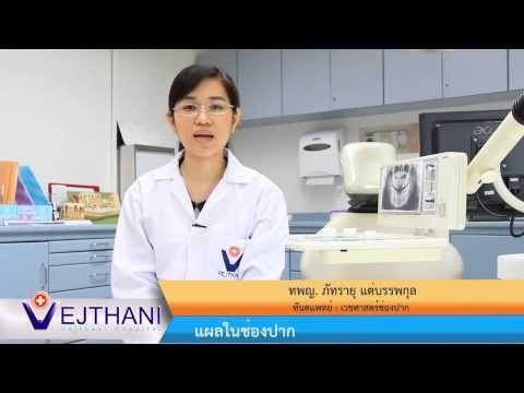สาเหตุโรคสะเก็ดเงินที่หนังศีรษะ มันฝรั่งในโรคสะเก็ดเงิน