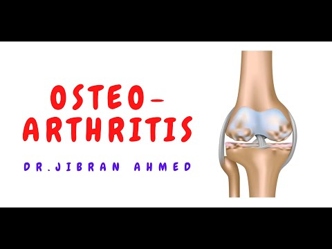 RHEUMATOID ARTHRITIS II BONES AND SOFT TISSUE II ARTHRITIS II ROBBINS 10TH E II PATHOLOGY LECTURES