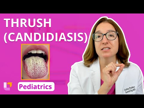 Thrush (Candidiasis): Integumentary System - Pediatric Nursing | @LevelUpRN