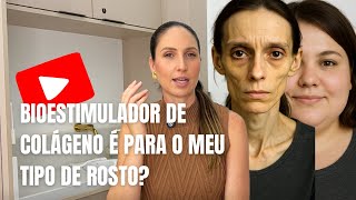 Bioestimulador de colágeno é para o meu tipo de rosto?
