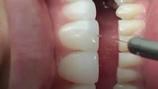 Hollywood smile Oujda