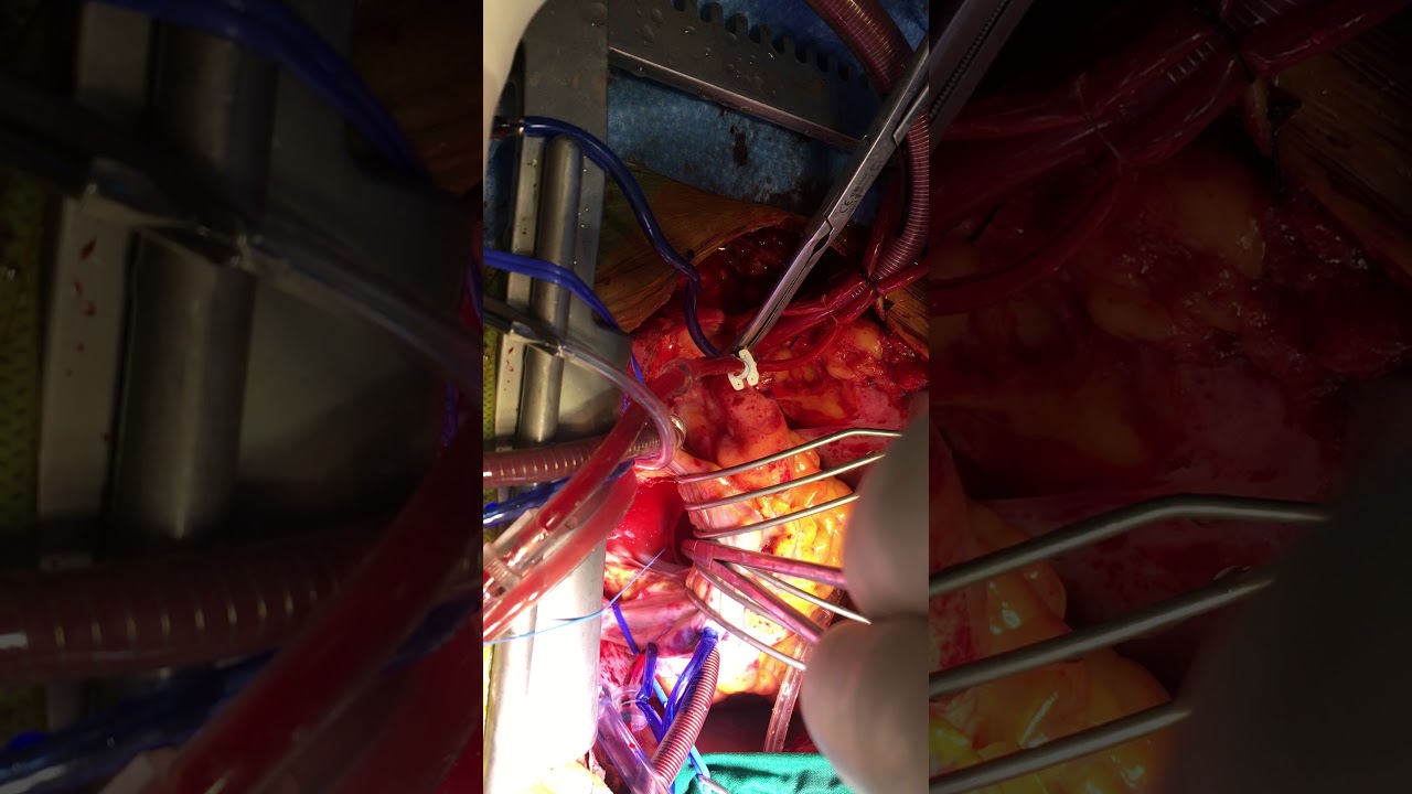 Eduardo Celedon Lavin-13