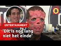 Henry 'Red Skull' liet zijn tong splijten en neus wegsnijden | Omroep Brabant