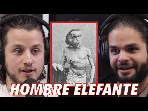 No soy un monstruo, soy un ser humano, un hombre