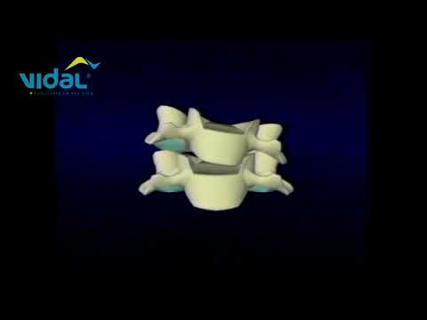 Inclinação Lateral Cervical - Vista Anterior – Vidal