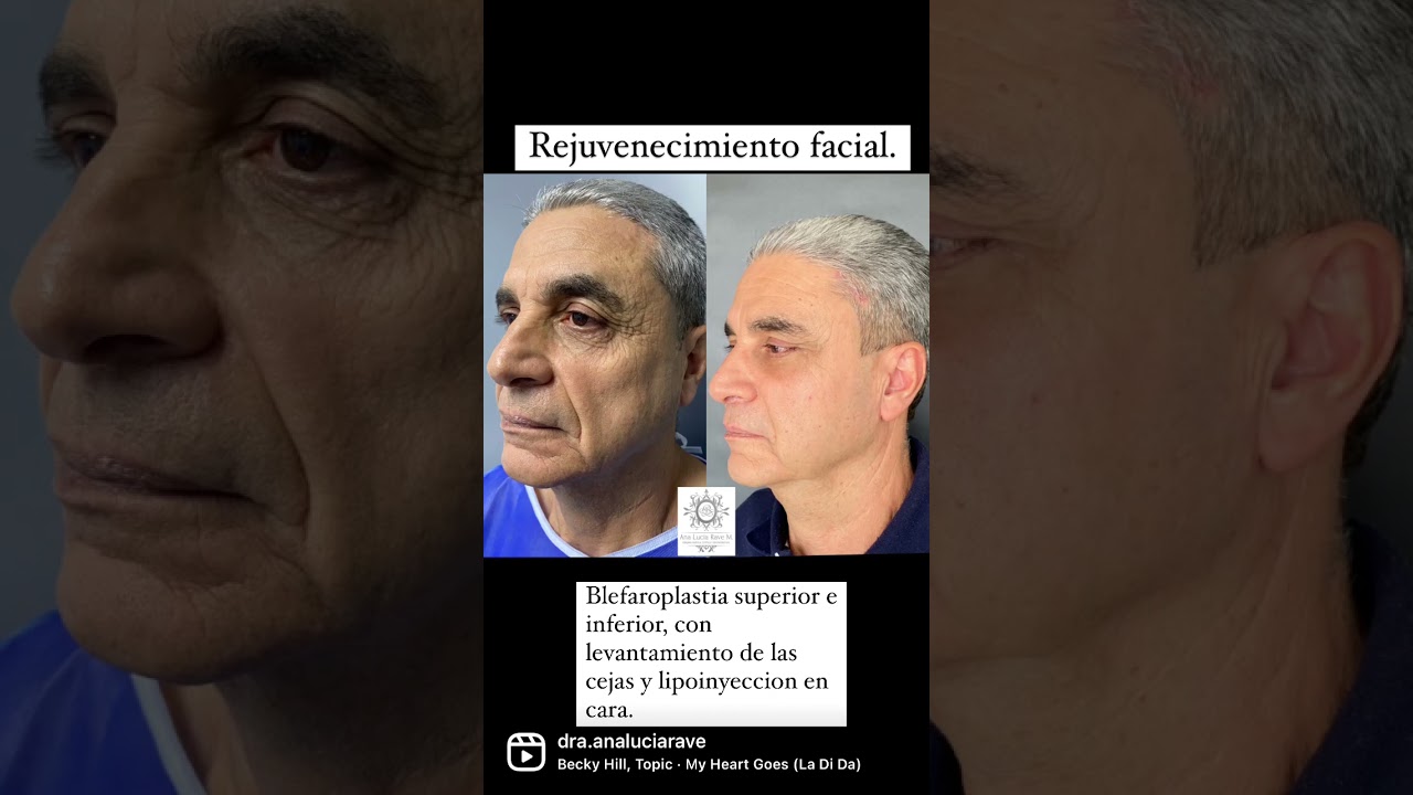 Ana Lucia Rave Martinez-30