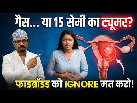 बच्चेदानी की गांठ के 5 नियम: कब नज़रअंदाज़ करें, कब कराएं इलाज?
