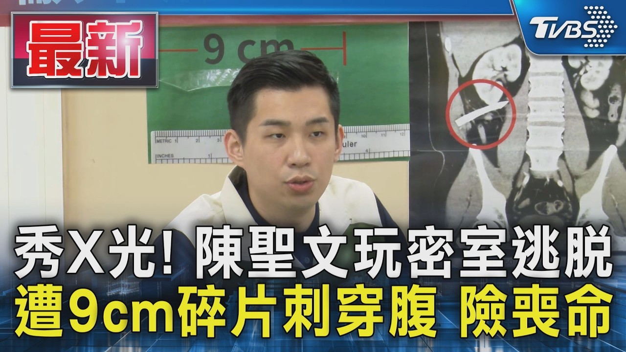 秀X光! 陳聖文玩密室逃脫 遭9cm碎片刺穿腹 險喪命|TVBS新聞 @TVBSNEWS01