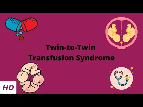 4 Ovarian Cancer Symptoms Every Woman Must Know