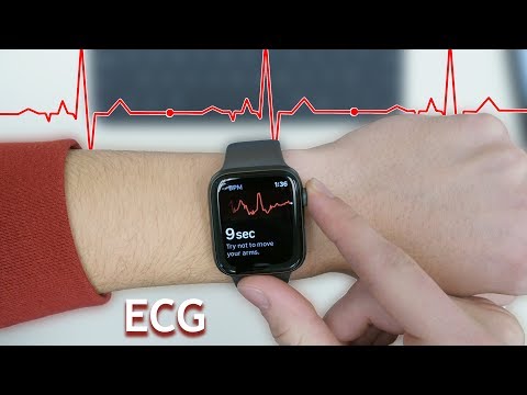 ECG Testing on Apple Watch!