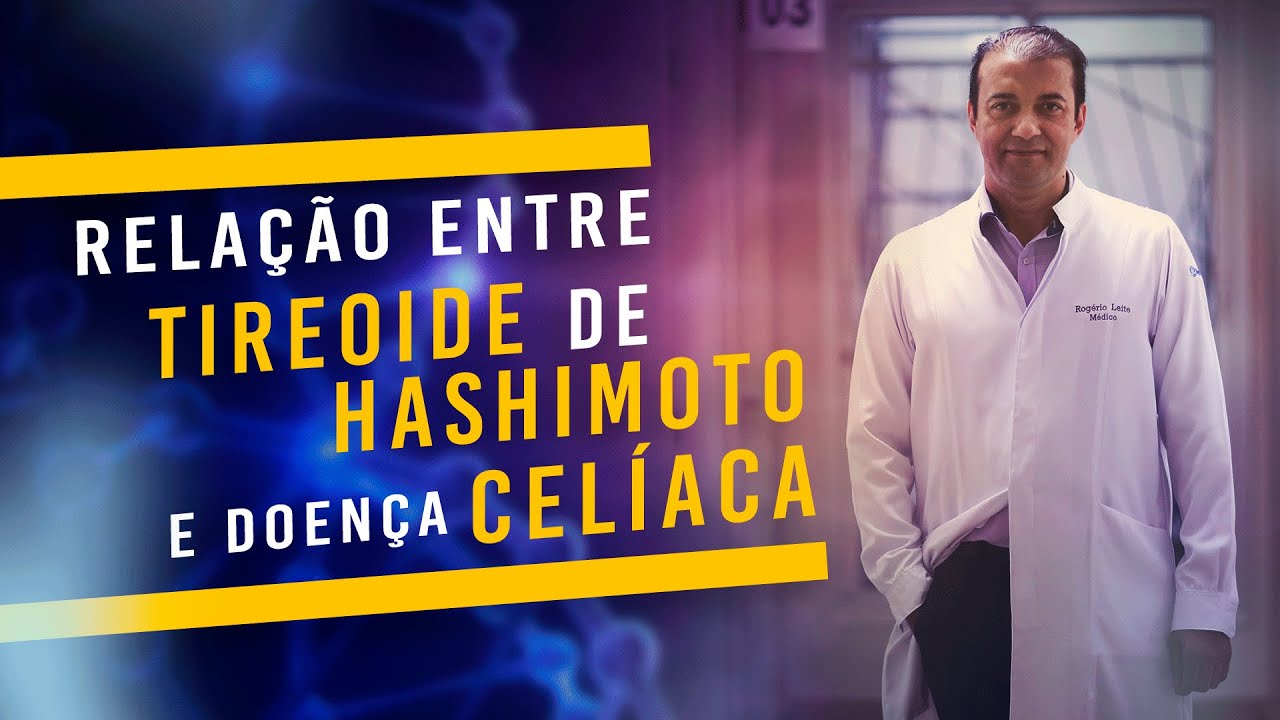 Tireoidite De Hashimoto: Qual Relação entre a Doença Celíaca E Tireoidite De Hashimoto