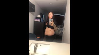 Update on Surgery at the Baltic Facility in Tijuana MX !