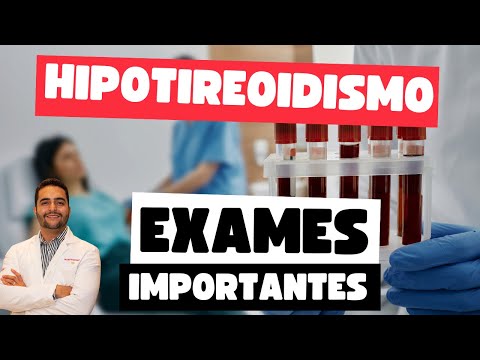 Essential Tests for Diagnosis and Treatment of Hypothyroidism