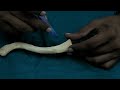 Osteology of Clavicle bone