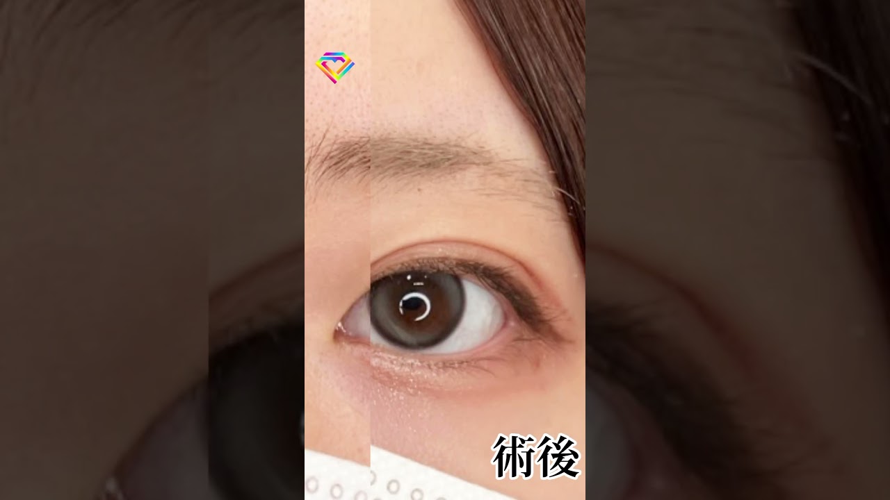 Youtubeのサムネイル