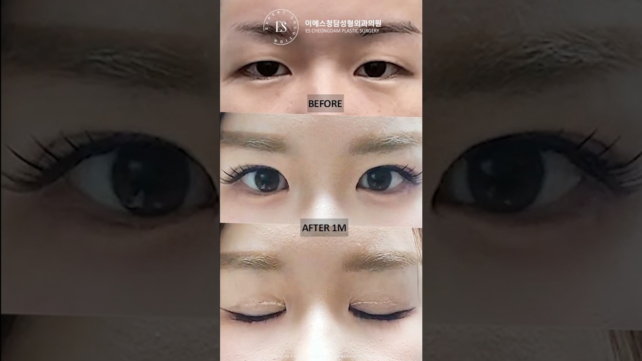 이에스 유튜브