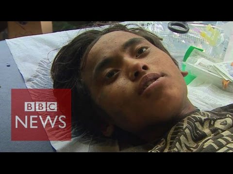 Nepal earthquake survivor: 'I survived by eating butter' BBC News