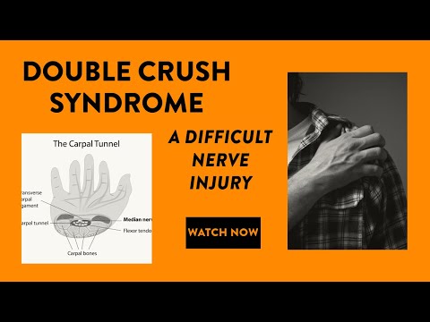 Double crush syndrome: A difficult nerve injury