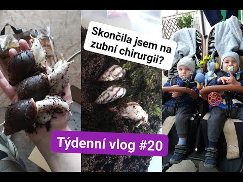 Týdenní vlog #20 Skončila jsem na zubní chirurgii?