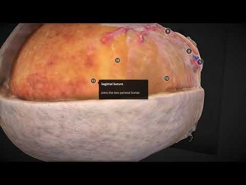 Pterional Model 4 Cureus