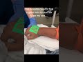 Vein Finder Devices