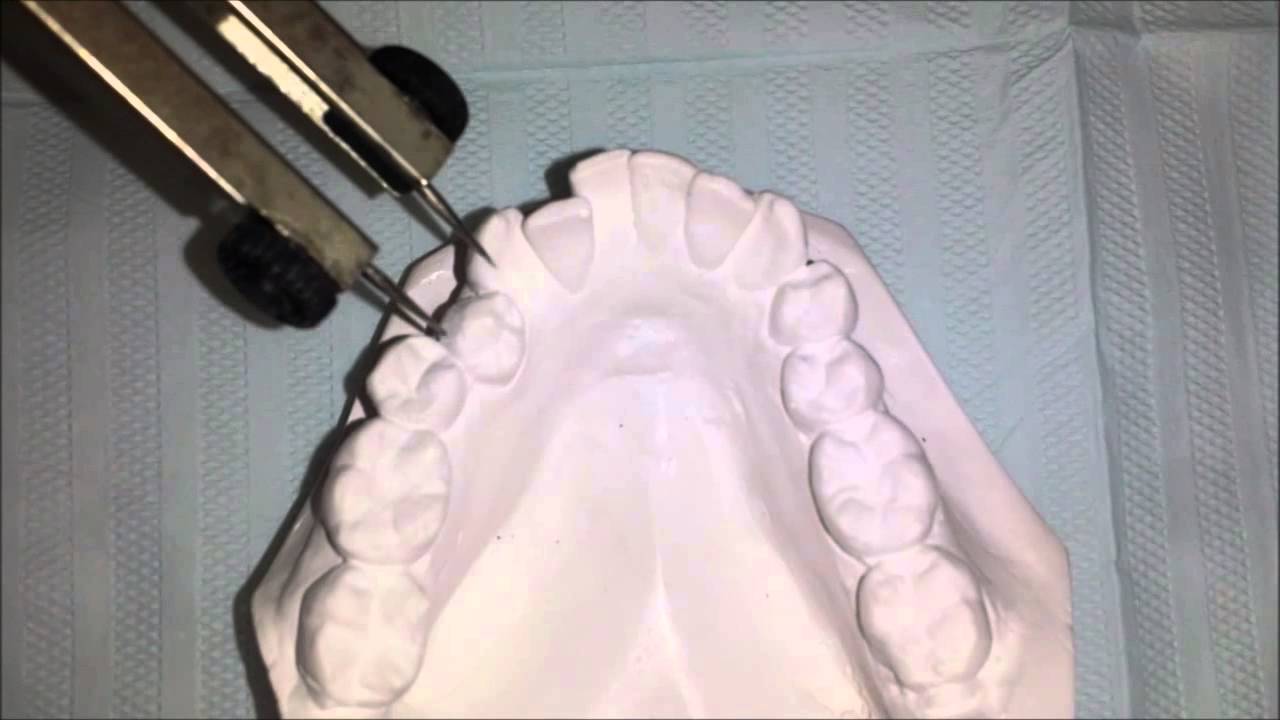 Watch Now Discrepância de modelo simplificada Discrepância de modelo simplificada